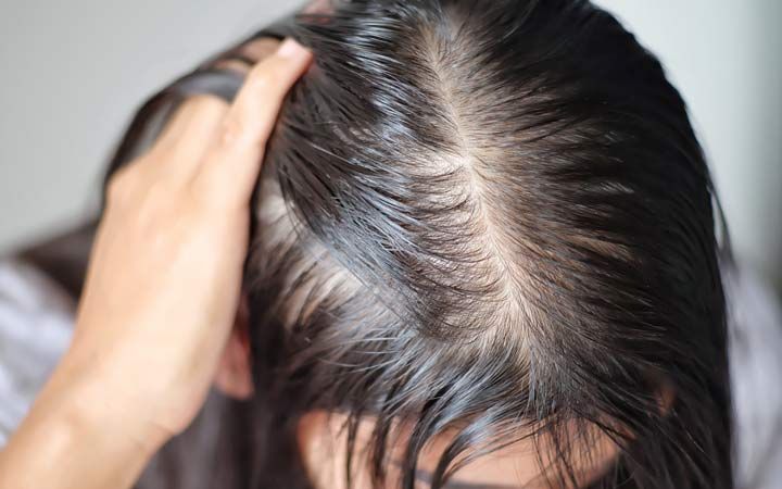 10 Most Common Hair Loss Myths for Women!