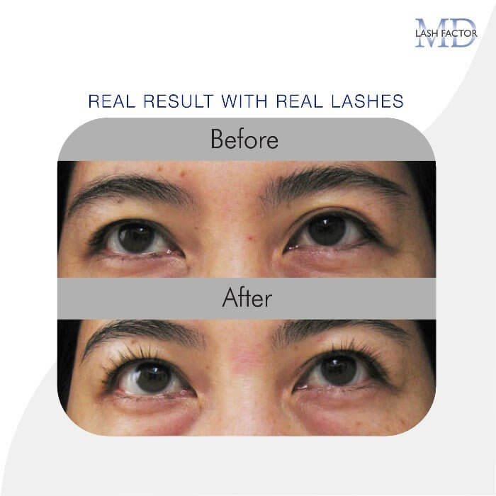 Before and after of Asian woman showing visibly lifted eyelids and thicker, longer lashes after using MD Lash Factor 3-Month Supply