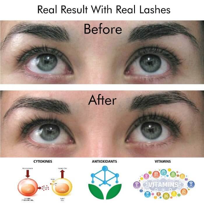 Before and after photo showing visible lash and brow transformation using MD Lash Factor Eyelash Conditioner with key ingredients listed: cytokines, vitamins, antioxidants – by MD Lash