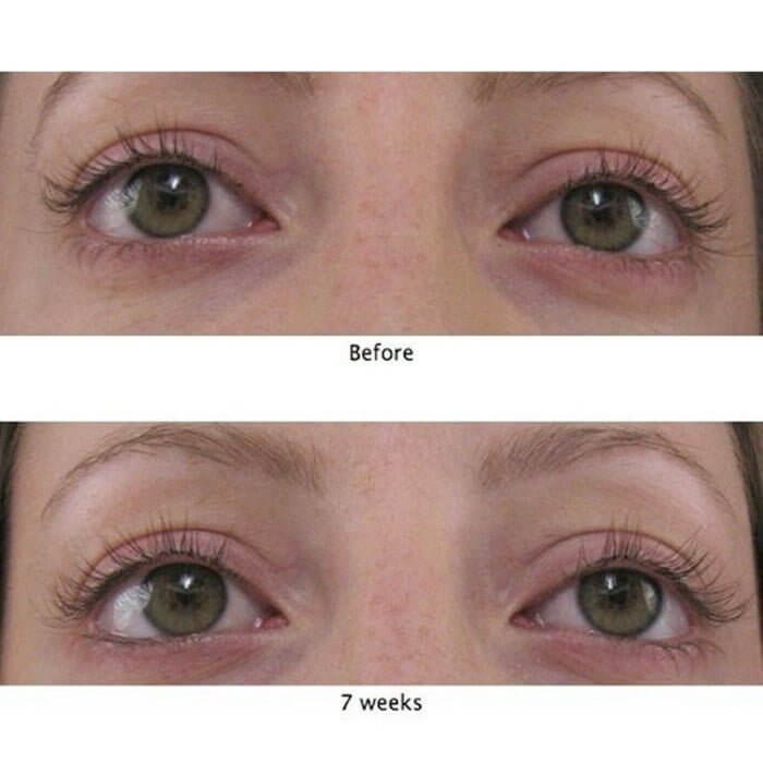 Mascara-free before and after image showing visibly longer, healthier lashes in 8 weeks with MD Lash Factor – ophthalmologist-tested lash serum by MD Lash